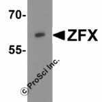 Western blot analysis of ZFX human small intestine tissue lysate with ZFX antibody at 1 μg/ml in (A) the absence and (B) the presence of blocking peptide.