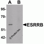 Western blot analysis of ESRRB in human heart tissue lysate with ESRRB antibody at 1 μg/mL in (A) the absence and (B) the presence of blocking peptide.