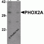 Western blot analysis of PHOX2A in rat brain tissue lysate with PHOX2A antibody at 1 μg/ml in (A) the absence and (B) the presence of blocking peptide.