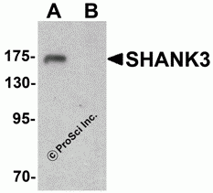 SHANK3 Peptide