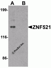 ZNF521 Peptide