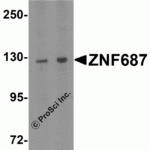 Western blot analysis of ZNF687 in Jurkat cell lysate with ZNF687 antibody at 0.5 μg/ml in (A) the absence and (B) the presence of blocking peptide.