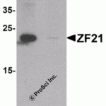 Western blot analysis of ZF21 in 3T3 cell tissue lysate with ZF21 antibody at 1 μg/ml in (A) the absence and (B) the presence of blocking peptide.
