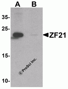 ZF21 Peptide