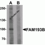 Western blot analysis of FAM193B in Jurkat cell lysate with FAM193B antibody at 1 μg/mL in (A) the absence and (B) the presence of blocking peptide.