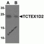 Western blot analysis of TCTEX1D2 in K562 cell lysate with TCTEX1D2 antibody at 1 μg/mL in (A) the absence and (B) the presence of blocking peptide.