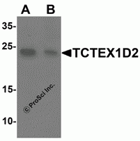 TCTEX1D2 Peptide