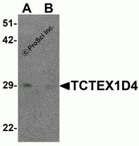 TCTEX1D4 Peptide