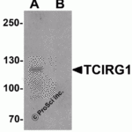 Western blot analysis of TCIRG1 in EL4 cell lysate with TCIRG1 antibody at 0.5 μg/ml in (A) the absence and (B) the presence of blocking peptide.