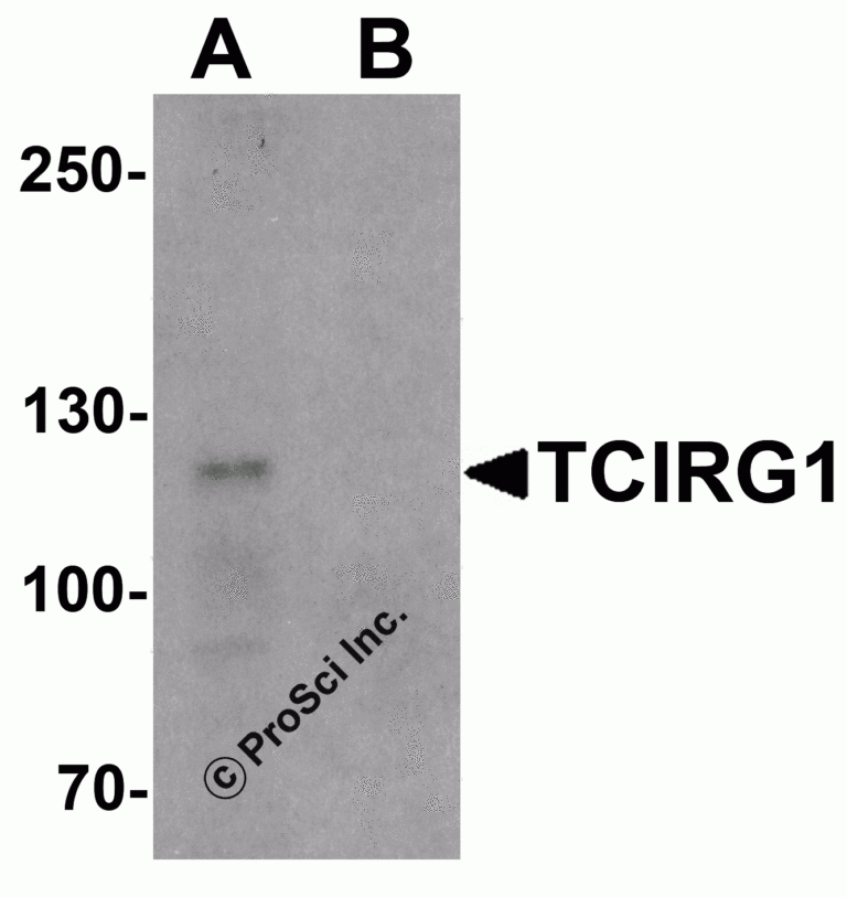 TCIRG1 Peptide