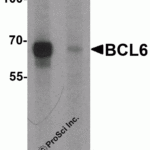 Western blot analysis of BCL6 in rat lung tissue lysate with Bcl6 antibody at 1 μg/ml in (A) the absence and (B) the presence of blocking peptide