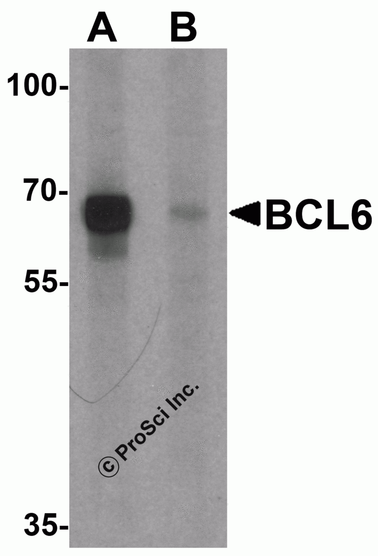 BCL6 Peptide