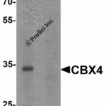 Western blot analysis of CBX4 in human brain tissue lysate with CBX4 antibody at 1 μg/ml in (A) the absence and (B) the presence of blocking peptide.