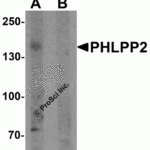 Western blot analysis of PHLPP2 in SW480 cell lysate with PHLPP2 antibody at 1 μg/ml in (A) the presence and (B) the absence of blocking peptide.