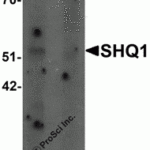 Western blot analysis of SHQ1 in human heart tissue lysate with SHQ1 antibody at 1 μg/mL in (A) the absence and (B) the presence of blocking peptide.