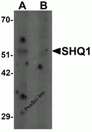 SHQ1 Peptide