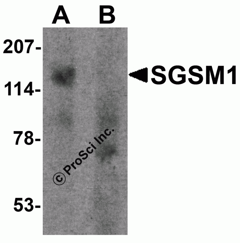 SGSM1 Peptide