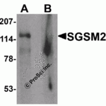 Western blot analysis of SGSM2 in human cerebellum tissue lysate with SGSM2 antibody at 1 μg/ml in (A) the absence and (B) the presence of blocking peptide
