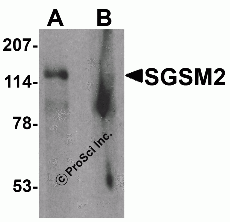 SGSM2 Peptide