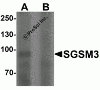 SGSM3 Peptide