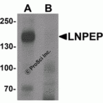 Western blot analysis of LNPEP in human lung tissue lysate with LNPEP antibody at 1 μg/mL in (A) the absence and (B) the presence of blocking peptide.