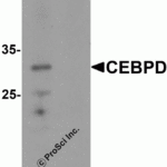 Western blot analysis of CEBPD in rat spleen tissue lysate with CEBPD antibody at 0.5 μg/mL in (A) the absence and (B) the presence of blocking peptide.