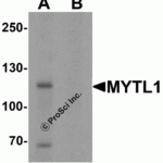 Western blot analysis of MYT1L in mouse brain tissue lysate with MYT1L antibody at 1 μg/mL in (A) the absence and (B) the presence of blocking peptide.