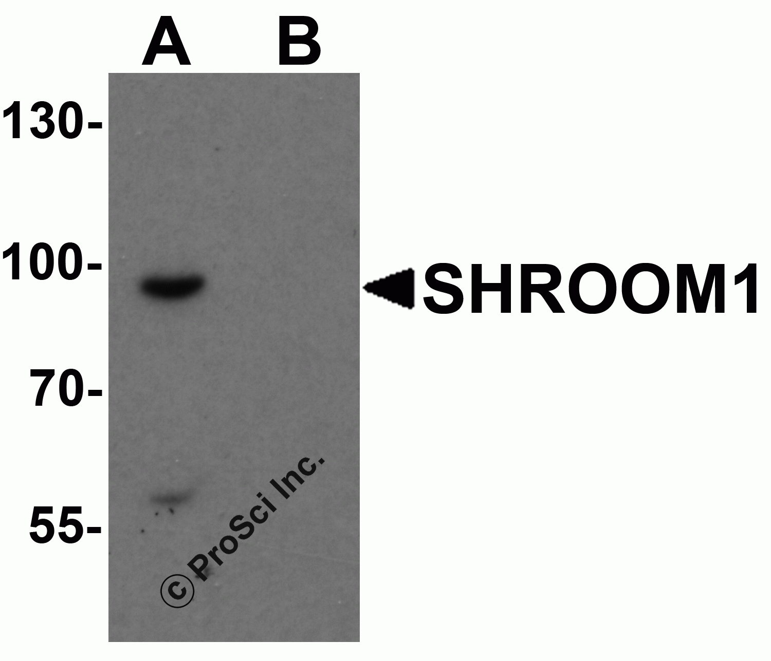 SHROOM1 Peptide