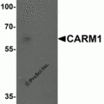 Western blot analysis of CARM1 in Jurkat cell lysate with CARM1 antibody at 1 μg/mL in (A) the absence and (B) the presence of blocking peptide.