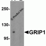 Western blot analysis of GRIP1 in HeLa cell lysate with GRIP1 antibody at μg/mL in (A) the absence and (B) the presence of blocking peptide.