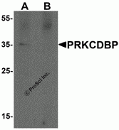 PRKCDBP Peptide