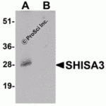 Western blot analysis of SHISA3 in human small intestine Tissue lysate with SHISA3 antibody at 1 μg/mL in (A) the absence and (B) the presence of blocking peptide.
