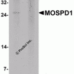 Western blot analysis of MOSPD1 in human brain tissue lysate with MOSPD1 antibody at 1 μg/mL in (A) the absence and (B) the presence of blocking peptide.