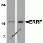 Western blot analysis of ERRF in HeLa cell lysate with ERRF antibody at 1 μg/mL in (A) the absence and (B) the presence of blocking peptide.