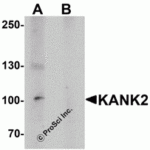 Western blot analysis of KANK2 in mouse brain tissue lysate with KANK2 antibody at 1 μg/mL in (A) the absence and (B) the presence of blocking peptide.
