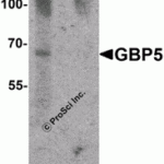 Western blot analysis of GBP5 in rat liver tissue lysate with GBP5 antibody at 1 μg/mL in (A) the absence and (B) the presence of blocking peptide.