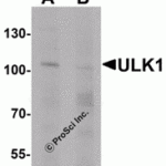 Western blot analysis of ULK1 in rat brain tissue lysate with ULK1 antibody at 1 μg/mL in (A) the absence and (B) the presence of blocking peptide.