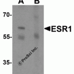 Western blot analysis of ESR1 in rat brain tissue lysate with ESR1 antibody at 1 μg/mL in (A) the absence and (B) the presence of blocking peptide.