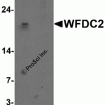 Western blot analysis of WFDC2 in A549 cell lysate with WFDC2 antibody at 1 μg/ml in (A) the absence and (B) the presence of blocking peptide.