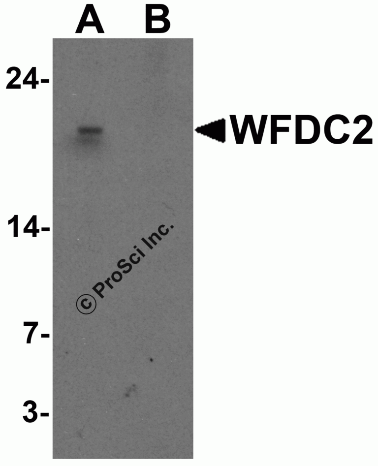 WFDC2 Peptide