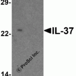 Western blot analysis of IL-37 in human lung tissue lysate with IL-37 antibody at 1 μg/ml in (A) the presence and (B) the absence of blocking peptide.