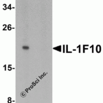 Western blot analysis of IL-1F10 in human liver tissue lysate with IL-1F10 antibody at 1 μg/ml in (A) the absence and (B) the presence of blocking peptide.