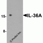 Western blot analysis of IL-36A in MCF7 cell lysate with IL-36A antibody at 1 μg/ml in (A) the absence and (B) the presence of blocking peptide.