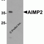 Western blot analysis of AIMP2 in HeLa cell lysate with AIMP2 antibody at 1 μg/ml in (A) the absence and (B) the presence of blocking peptide.