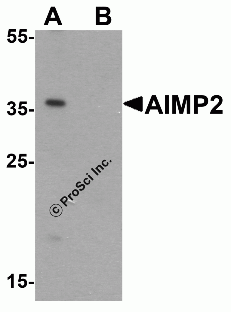 AIMP2 Peptide