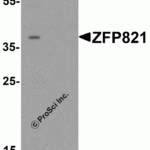 Western blot analysis of ZNF821 in Jurkat cell lysate with ZNF821 antibody at 0.5 μg/ml in (A) the absence and (B) the presence of blocking peptide.