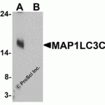 Western blot analysis of MAP1LC3C in human brain tissue lysate with MAP1LC3C antibody at 1 μg/ml in (A) the absence and (B) the presence of blocking peptide.