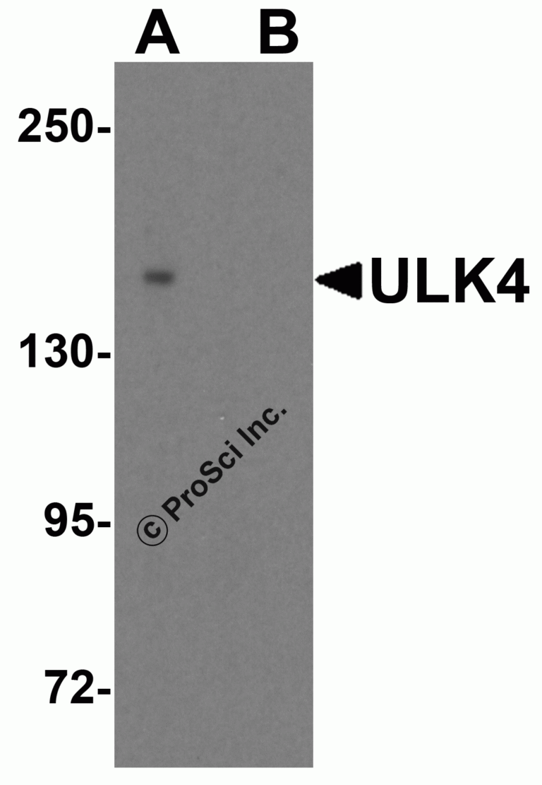 ULK4 Peptide
