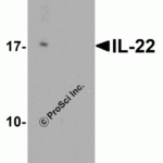 Western blot analysis of IL-22 in HeLa cell lysate with IL-22 antibody at 1 μg/ml in (A) the absence and (B) the presence of blocking peptide.