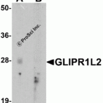 Western blot analysis of GLIPR1L2 in human testis tissue lysate with GLIPR1L2 antibody at 1 μg/ml in (A) the absence and (B) the presence of blocking peptide.